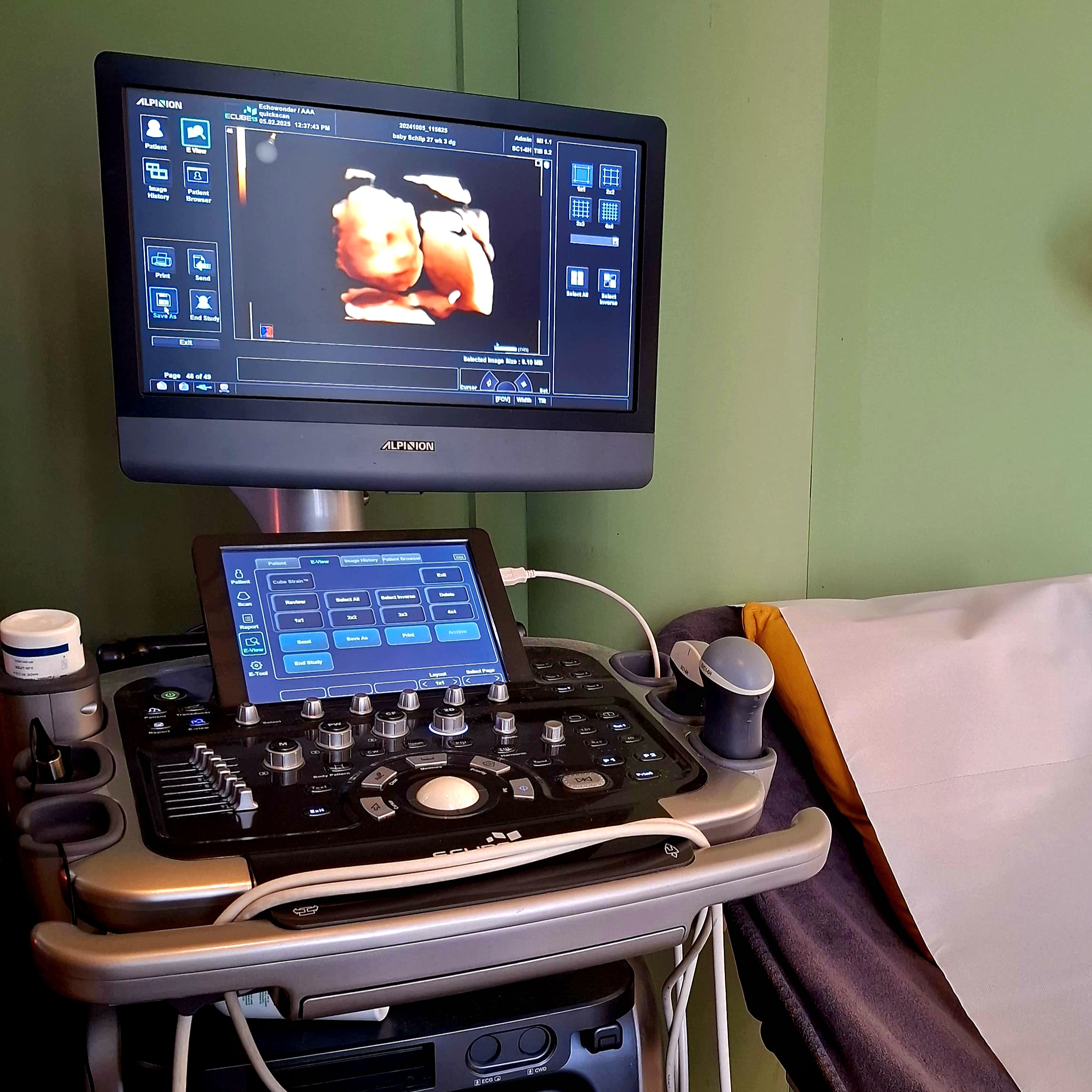 ZorgWonder.nl - 3D - 4D pretecho echograaf