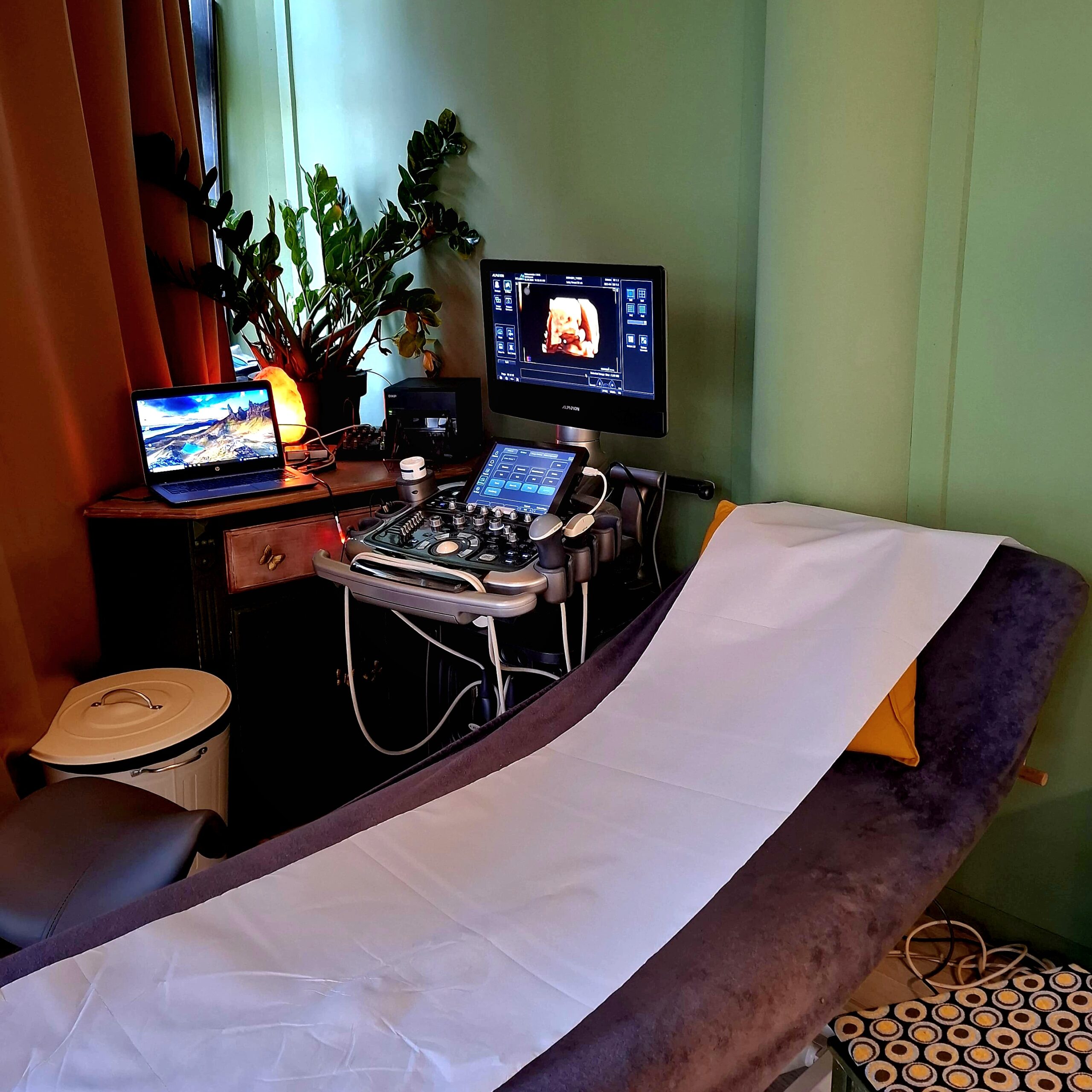 ZorgWonder.nl - Pretecho behandelbank en echograaf (2)