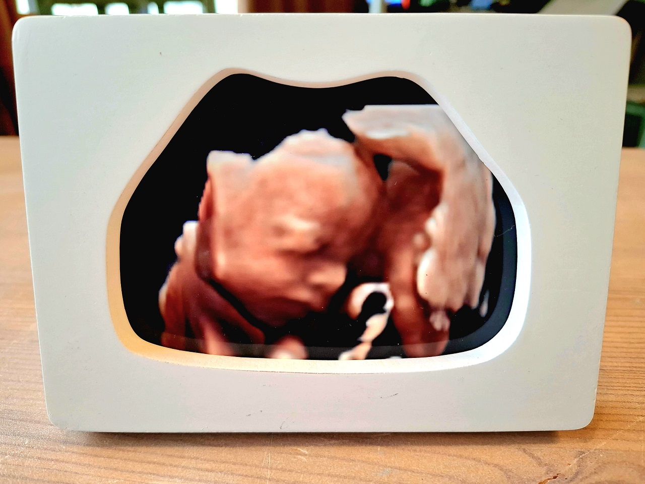 ZorgWonder.nl - pretecho - echo in houten lijstje (3)