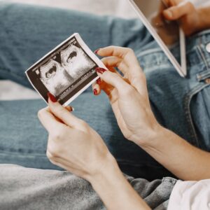 ZorgWonder.nl - 2d pretecho echo foto bekijken (2)