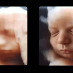3D echo foto naar 6D